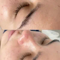 خدمات تخصصی پاکسازی و فیشیال پوست|خدمات آرایشگری و زیبایی|کرج, آق تپه|دیوار