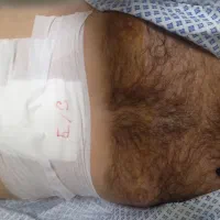 نگهداری از سالمند وبیمار درمنزل