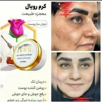 جهت خرید پیام بدید .شماره واتساپ براتون میفرستم