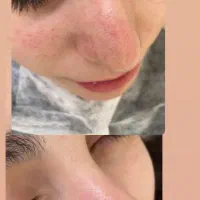 مدل فیشیال تکنیک پوست کره ای با بهترین قیمت۵۰۰