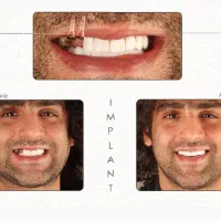 صفرتاصد خدمات دندانپزشکی به صورت اقساطی|خدمات آرایشگری و زیبایی|بوشهر, |دیوار