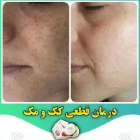 نمایندگی رویال دریاسوج ببرراضی نبودی پس میگیریم|آرایشی، بهداشتی، درمانی|دوگنبدان, |دیوار