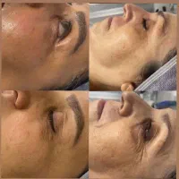 جشنواره لاغری 3تا12سانت در1جلسه وهایفوتراپی vip|خدمات آرایشگری و زیبایی|رشت, پارک شهر|دیوار