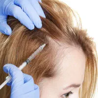 مزونیدلینگ و مزوتراپی موی سر /رفع تیرگی زیر چشم