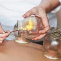 بادکش گرم/پنس بادکش/لیوان بادکش/لیوان حجامت|آرایشی، بهداشتی، درمانی|قم, دانش|دیوار