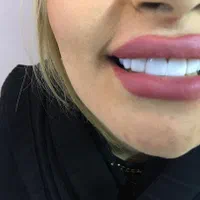 دندانپزشکی انجام تمامی خدمات دندانپزشکی|خدمات آرایشگری و زیبایی|تبریز, |دیوار