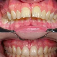 ارتودنسی از دم قسط، هرفک 55 میلیون (فقط تا 1 هفته)|خدمات زیبایی و سلامت|تهران, دروس|دیوار