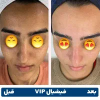 پاکسازی VIP پوست در کلینیک ماهان