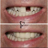 وام دندانپزشکی دکتر اسلامی فر|خدمات آرایشگری و زیبایی|ساوه, |دیوار