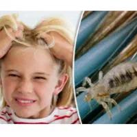 قویترین محلول ضد شپش تضمینی