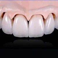 خدمات دندانپزشکی اقساطی بدون سود