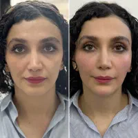 مرکزپوست ولیزرنهال