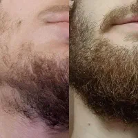 به ریش هست به ریشه هم هست ریش نداری بخون