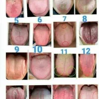 چکاپ و سونوگرافی از بدن با علم زبان شناسی