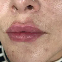 فیشیال،پاکسازی،جوانسازی پوست و مو|خدمات زیبایی و سلامت|تهران, شادمان|دیوار