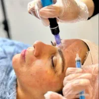 آموزش حرفه ای فیشیال و استخدام در مجموعه ما|خدمات آرایشگری و زیبایی|مشهد, طلاب|دیوار