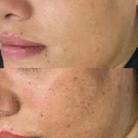 بدون کرمپودر پوست صاف داشته باش