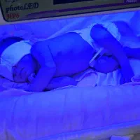 اجاره دستگاه زردی نوزاد (فتوتراپی)