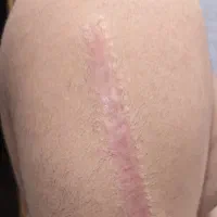 دستگاه کاموفولاژ ورنگ
