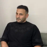 کاشت مو و ابرو|خدمات آرایشگری و زیبایی|قم, پامنار|دیوار