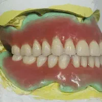 دندانپزشکی زیبایی تخفیف شب یلدااقساط|خدمات آرایشگری و زیبایی|پارس‌آباد, |دیوار