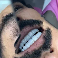 جشنواره ویژه ونیر کامپوزیت