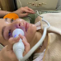 فیشال و پاکسازی پوست. مزونیدلینگ و پلکسر