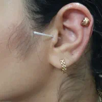 سوراخ گوش