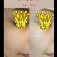 خدمات پاکسازی و جوانسازی پوست|خدمات آرایشگری و زیبایی|لاهیجان, مهرگان|دیوار