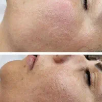 فیشیال VIP  (با تخفیف ویژه)تا دوشنبه