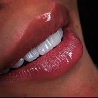 ایمپلنت و خدمات دندانپزشکی اقساطی بدون سود