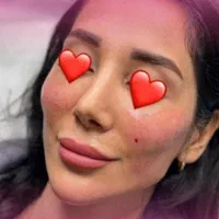 ساکشن غبغب وشکم. کاشت ابرو .|خدمات آرایشگری و زیبایی|پرند, |دیوار