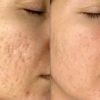 مزونیدلینگ کاملا تضمینی خانم ها و اقایون