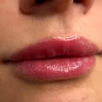 تخفیف یلدایی شیدینگ لب کنگان