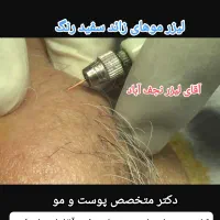 لیزر مو زائدآقاخانم(کل بدن رایگان) شعبه دوم|خدمات آرایشگری و زیبایی|نجف‌آباد, بازار|دیوار