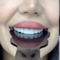 کامپوزیت دندان اف ویژه فکی ۵۸۰۰ و آموزش