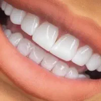 زیبایی کامپوزیت