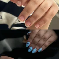 کاشت ناخن