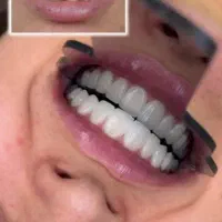 دندانپزشکی و زیبایی بدون پیش پرداخت|خدمات آرایشگری و زیبایی|قم, نوقطار|دیوار