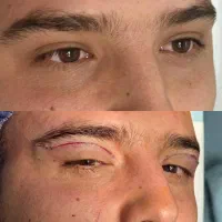 انجام تمام خدمات زیبایی صورت وبدن|خدمات آرایشگری و زیبایی|شاهیوند, |دیوار