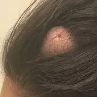 جراحی ناخن لیپوم توده چربی ختنه ژل بوتاکس|خدمات آرایشگری و زیبایی|مشهد, طلاب|دیوار
