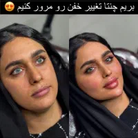 تخفیف جشنواره تزریق ژل و فیلر لب و فول فیس در مطب|خدمات آرایشگری و زیبایی|اصفهان, چرخاب|دیوار