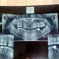 آموزش دستیاری دندانپزشکی