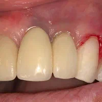 دندانپزشک قسطی بدون پیش پرداخت کلیه خدمات|خدمات آرایشگری و زیبایی|اصفهان, دشتستان|دیوار