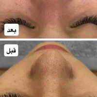 فیشیال تخصصی پوست