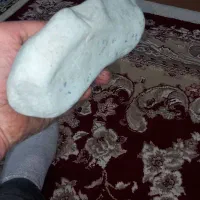 یک سنگ کلسیون بی نظیربه شکل پای یک خانم دقیقن|کلکسیون اشیاء عتیقه|علی‌آباد کتول, |دیوار