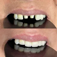 دندانپزشکی چناران