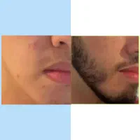 جذابیت در 25روز