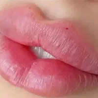 ژل بوتاکس گلوتاتیون سفید کننده بمدت ۳ روز خاش|خدمات آرایشگری و زیبایی|خاش, |دیوار