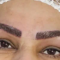 کاشت ابرو